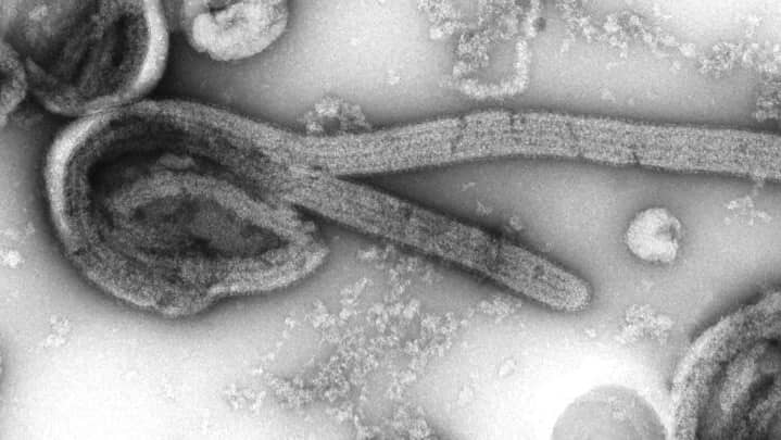 Tanzanie/Virus de Marburg : déjà 5 cas détectés dans le pays