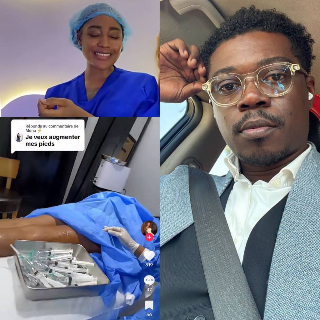 Alerte esthétique au Cameroun : Dr Albert Ze dénonce le «Body Filler» de Croqueuse de Diamant sur les réseaux sociaux
